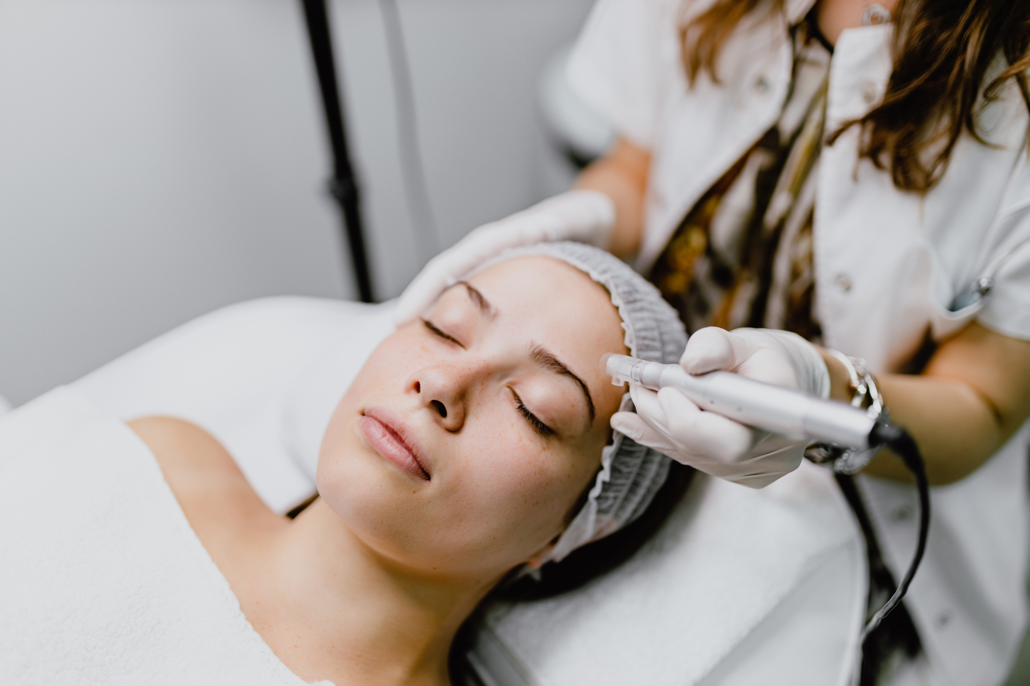 Young woman having a collagen induction therapy